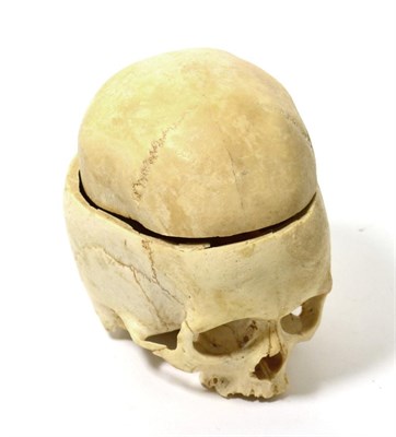 Lot 317 - Part human skull and top