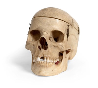 Lot 5180 - Human Skull with sprung lower jaw and removable top