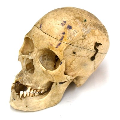 Lot 49 - Human Skull with removable top held on by two hooks