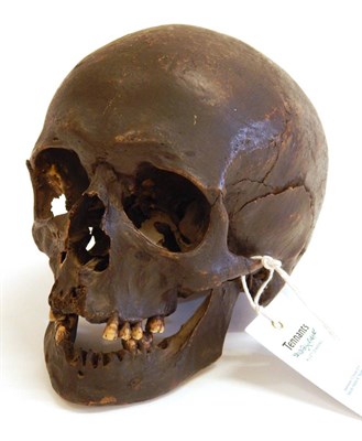 Lot 201 - Human Skull, male, (under 40) from Ireland dug up in 1945 in a peat bog, 16.5cm by 20.5cm (a/f)