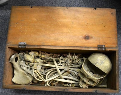 Lot 1425 - A Medical Part Human Skeleton, A Young, 57 Forest Road, Edinburgh, in original pine box with...