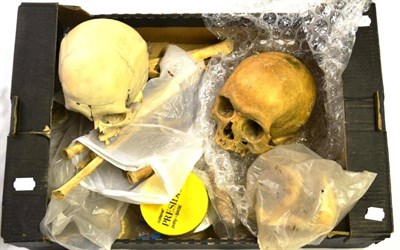 Lot 1426 - A Collection of Various Human Bones, including two skulls, diseased bones (including a Jordan...