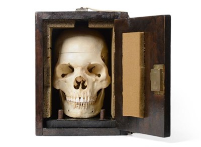 Lot 1134 - Human Skull mounted on stand in wooden case, with sprung jaw and removable top