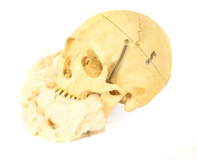 Lot 131 - Medical Human Half Skeleton