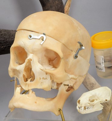 Lot 345 - Skulls/Anatomy: An Interesting Collection of...