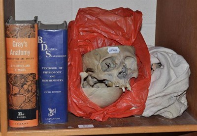 Lot 90 - Part skeleton with skull and two medical text books