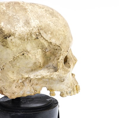 Lot 209 - Plaster Human Upper Skull