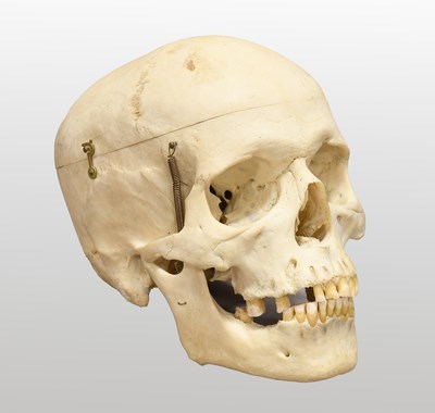 Lot 125 - Human Skull