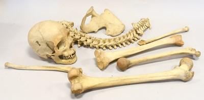 Lot 123 - Human Half Skeleton