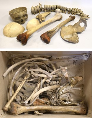 Lot 124 - Human Half Skeleton