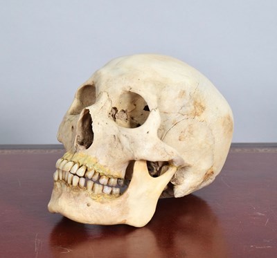 Lot 139 - Human Skull