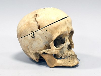 Lot 114 - Human Medical Skull