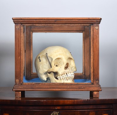 Lot 3125 - Human Medical Skull
