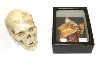 Lot 3165A - Human Skull with sprung jaw and removable top; together with a three dimensional wax medical...