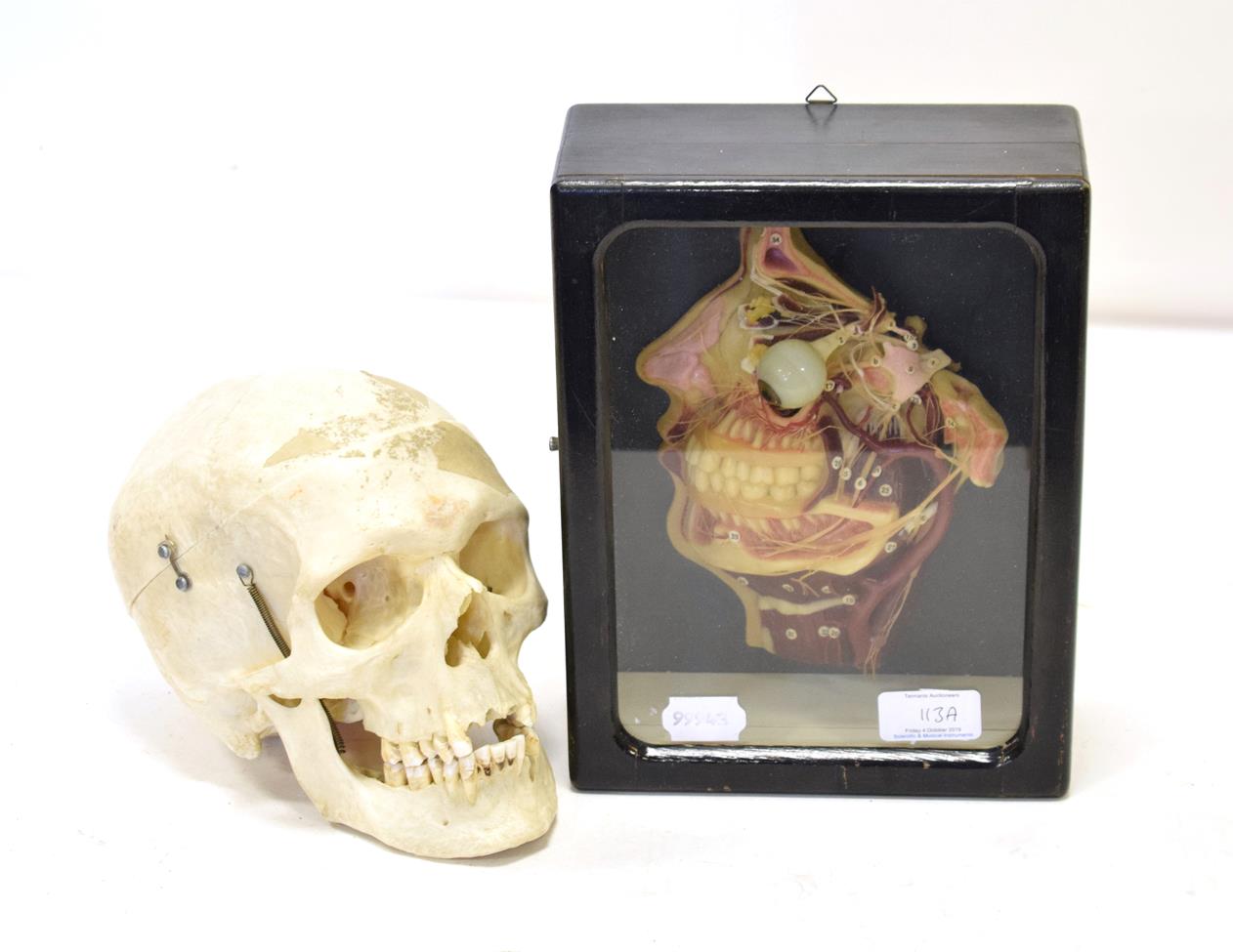 Lot 113 - Human Skull with sprung jaw and removable top; together with a three dimensional wax medical...