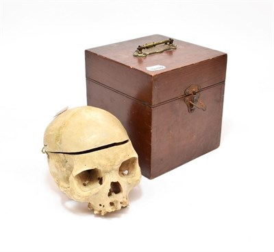 Lot 2113 - Human Skull with removable top section, in stained wood case (some damage)