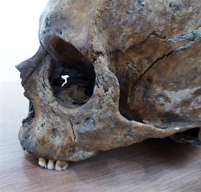 Lot 3091 - Medieval Upper Human Skull   The skull was acquired by the vendor from an archaeologist in...