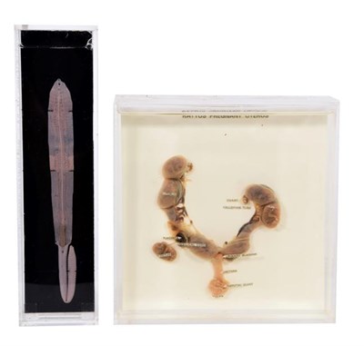 Lot 75 - Natural History: A Wet Specimen of a Garden Worm and a Pregnant Rat Uterus, circa late 20th...